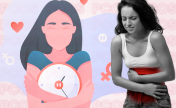 Best PCOS doctor in Dubai