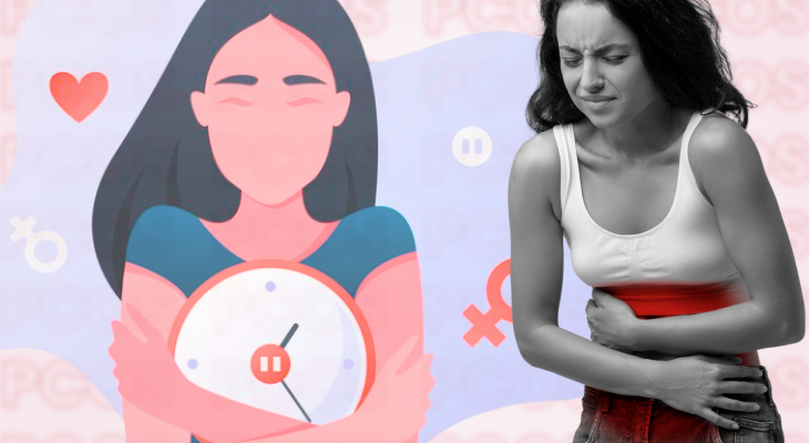 Best PCOS doctor in Dubai