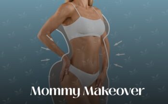 Mommy Makeover Dubai