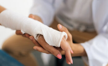 Hand Surgery