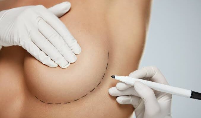 Breast Augmentation in Dubai